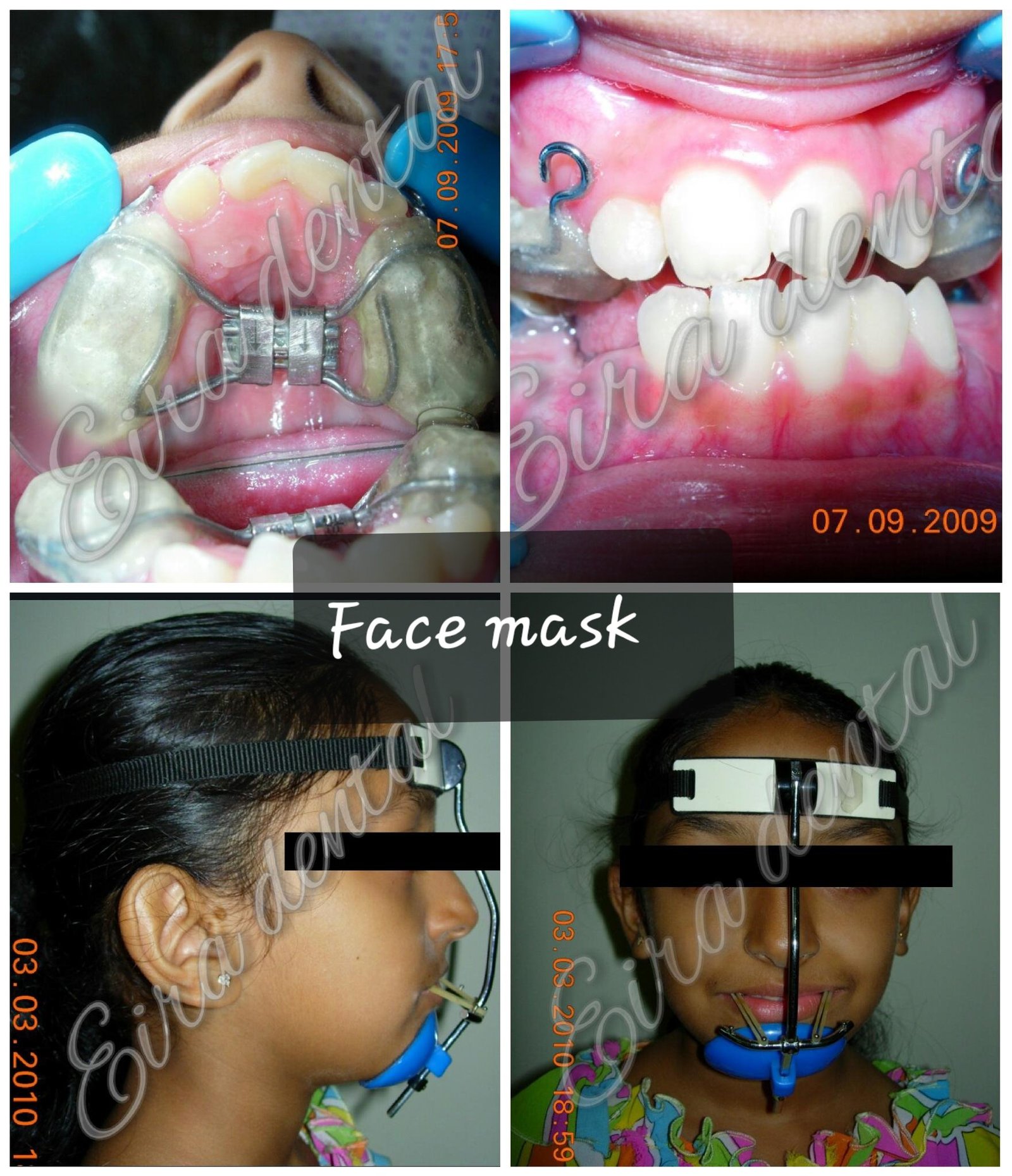 Eira Dental Clinic | www.eiraldentalclinic.com Best Dental Clinic in Mangalore Karnataka