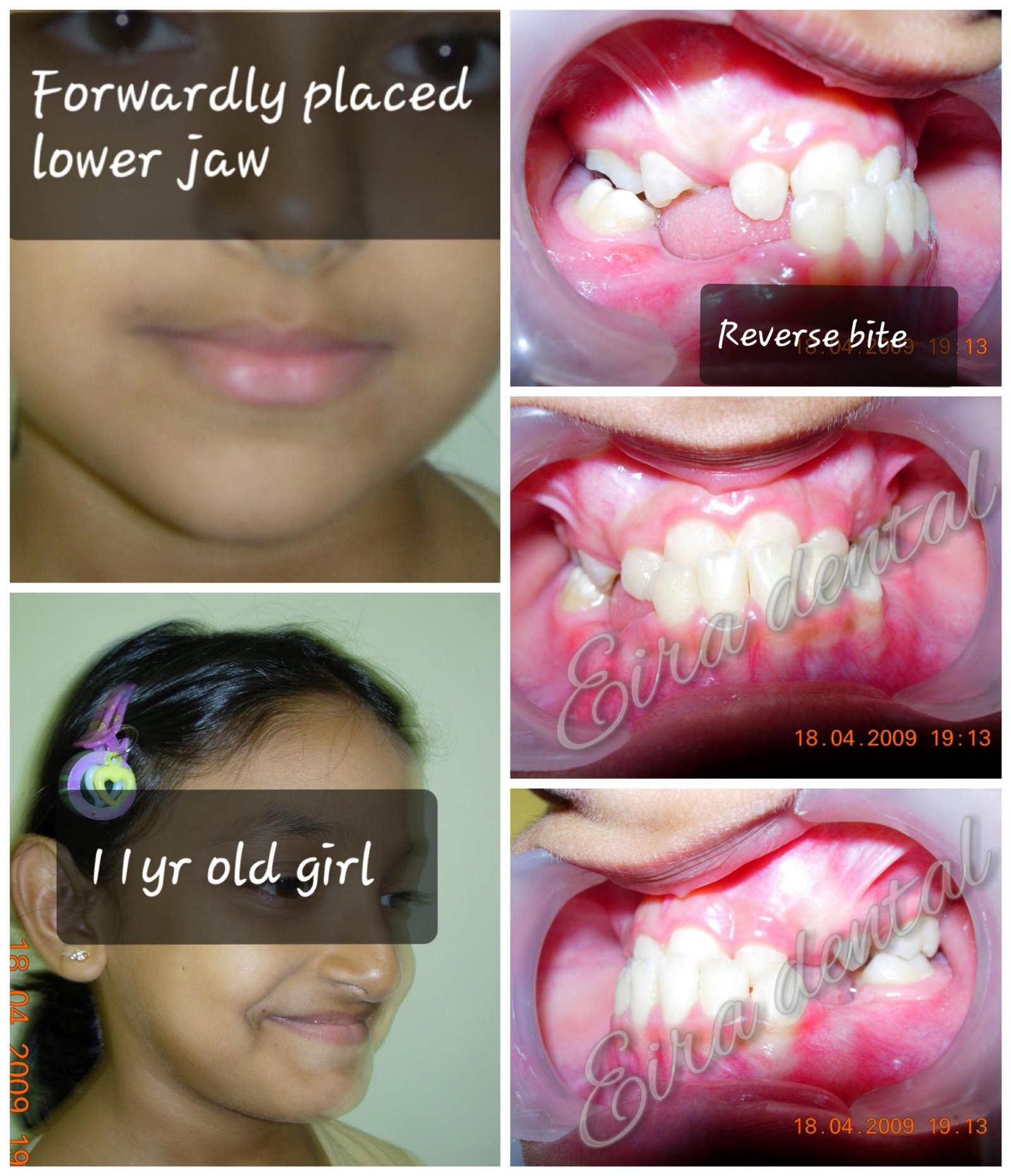 Eira Dental Clinic | www.eiraldentalclinic.com Best Dental Clinic in Mangalore Karnataka