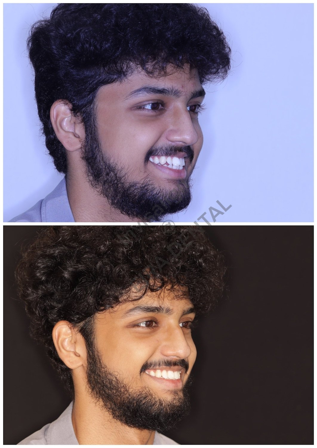 Eira Dental Clinic | www.eiraldentalclinic.com Best Dental Clinic in Mangalore Karnataka