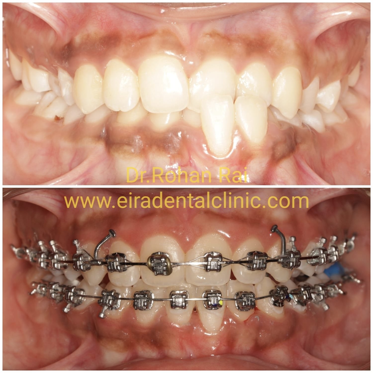 Eira Dental Clinic | www.eiraldentalclinic.com Best Dental Clinic in Mangalore Karnataka