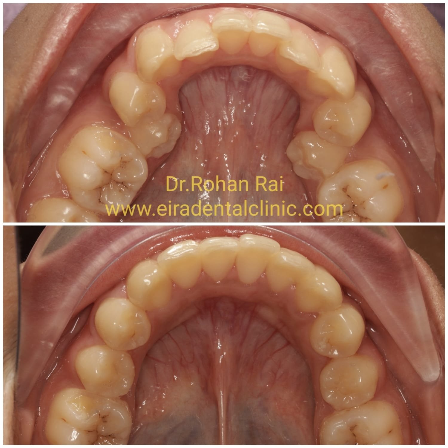 Eira Dental Clinic | www.eiraldentalclinic.com Best Dental Clinic in Mangalore Karnataka