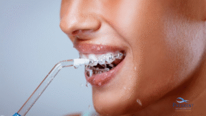 Water Flosser